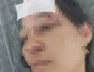 YAZLIKÇI AİLEYE AİDAT DAYAĞI!