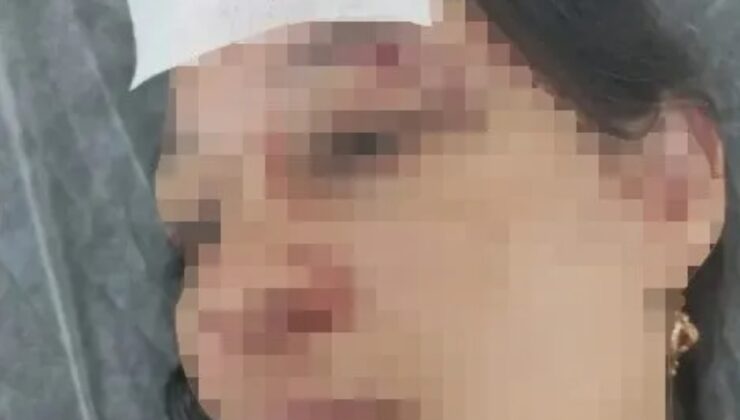 YAZLIKÇI AİLEYE AİDAT DAYAĞI!