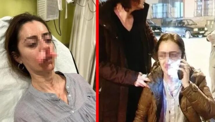 VAHŞETİN ADRESİ EDİRNE! ORTALIK KANA BULANDI!